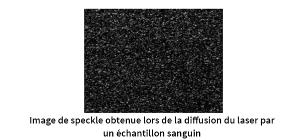 Image de speckle utilisée pour la surveillance anticoagulant